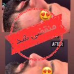 کلینیک زیبایی رسا در گلسار رشت