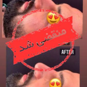 کلینیک زیبایی رسا در گلسار رشت