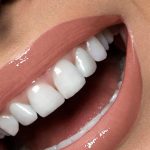 مطب دندانپزشکی ملورین در میدان توحید کرج