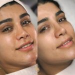 مرکز تخصصی پوست و مو سحر در ساری