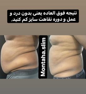 کلینیک لاغری و لیزر منتها در کیانپارس اهواز
