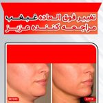 کلینیک لاغری و لیزر منتها در کیانپارس اهواز