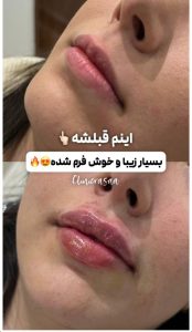 کلینیک زیبایی رسا در گلسار رشت