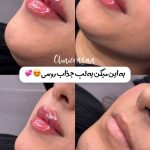 کلینیک زیبایی رسا در گلسار رشت