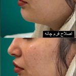 کلینیک زیبایی رسا در گلسار رشت