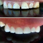 مطب دندانپزشکی دکتر صدف ساز در بلوار پاسداران بندرعباس