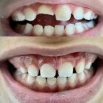 مطب دندانپزشکی دکتر صدف ساز در بلوار پاسداران بندرعباس