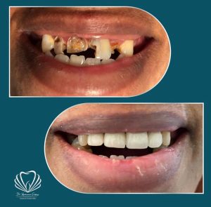 مطب دندانپزشکی دکتر صدف ساز در بلوار پاسداران بندرعباس