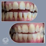 مطب دندانپزشکی دکتر صدف ساز در بلوار پاسداران بندرعباس