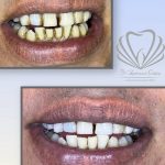 مطب دندانپزشکی دکتر صدف ساز در بلوار پاسداران بندرعباس