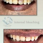 مطب دندانپزشکی دکتر صدف ساز در بلوار پاسداران بندرعباس