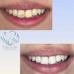 مطب دندانپزشکی دکتر صدف ساز در بلوار پاسداران بندرعباس