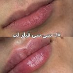 کلینیک زیبایی مهوان در فردیس کرج