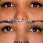 کلینیک زیبایی مهوان در فردیس کرج