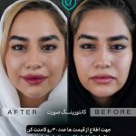 کلینیک زیبایی مهوان در فردیس کرج