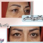 کلینیک زیبایی نئوفیس در اندرزگو تهران