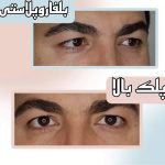 کلینیک زیبایی نئوفیس در اندرزگو تهران