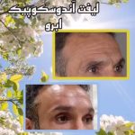 کلینیک زیبایی نئوفیس در اندرزگو تهران