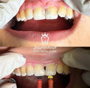 کلینیک دندانپزشکی رویال در لنگرود