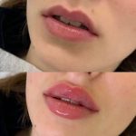 کلینیک زیبایی عزیزی در کرمانشاه