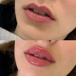 کلینیک زیبایی عزیزی در کرمانشاه