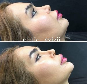 کلینیک زیبایی عزیزی در کرمانشاه