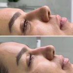 کلینیک زیبایی عزیزی در کرمانشاه