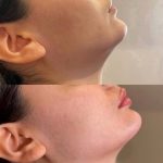 کلینیک زیبایی عزیزی در کرمانشاه