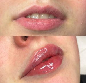 کلینیک زیبایی پرواز در باغ فیض اسلامشهر