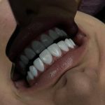 دندانپزشکی آف کلینیک در صادقیه تهران