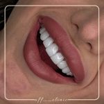 دندانپزشکی آف کلینیک در صادقیه تهران