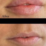 مطب پوست و مو و زیبایی Today در نارمک تهران