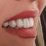 مطب دندانپزشکی دکتر احمدی در تبریز