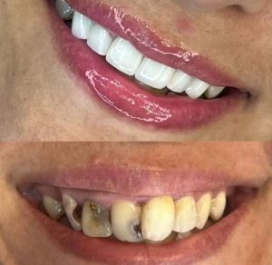 مطب دندانپزشکی دکتر احمدی در تبریز