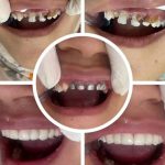 مطب دندانپزشکی دکتر احمدی در تبریز