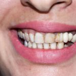 دندانپزشکی دکتر سرلک در خرم آباد