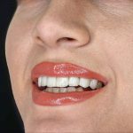 دندانپزشکی دکتر سرلک در خرم آباد