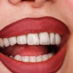 دندانپزشکی دکتر سرلک در خرم آباد