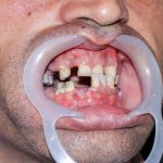 دندانپزشکی دکتر سرلک در خرم آباد