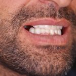 دندانپزشکی دکتر سرلک در خرم آباد