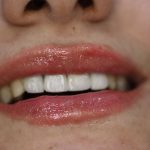 دندانپزشکی دکتر سرلک در خرم آباد