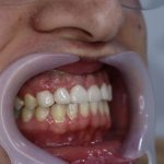 دندانپزشکی دکتر سرلک در خرم آباد