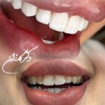 کلینیک دندانپزشکی کارزان در تهران