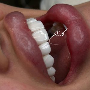 کلینیک دندانپزشکی کارزان در تهران