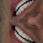 کلینیک دندانپزشکی کارزان در تهران