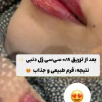 کلینیک زیبایی لنادل در بلوار سجاد مشهد