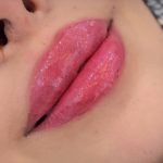 کلینیک زیبایی لنادل در بلوار سجاد مشهد