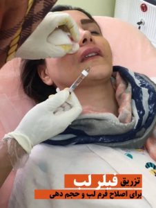 مطب زیبایی دکتر اشرفی در مشهد