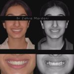 دکتر زهرا مردانی متخصص ارتودنسی در بوشهر