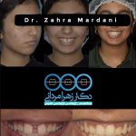 دکتر زهرا مردانی متخصص ارتودنسی در بوشهر